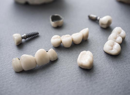 implants for teeth