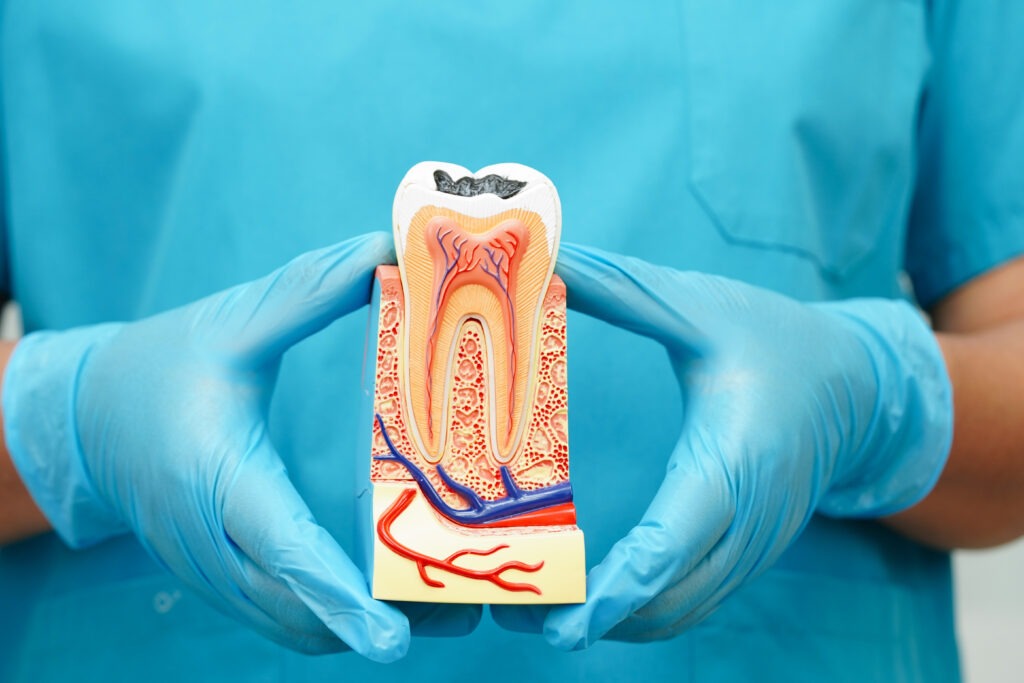 What to Expect During a Root Canal